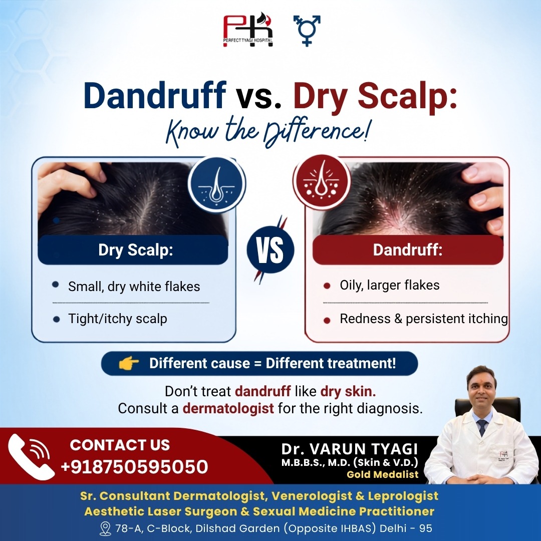 Causes of Dandruff in Women and Its Treatment